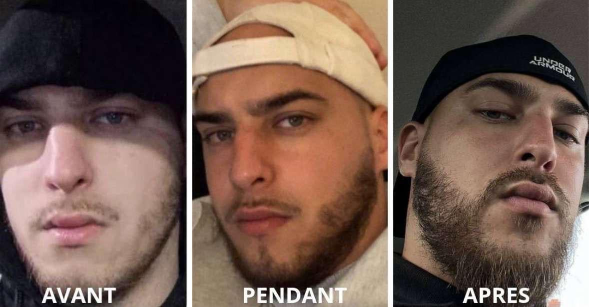 2 ACTIVATEUR DE POUSSE + ROLLER OFFERT - CURE 2 MOIS