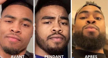 2 ACTIVATEUR DE POUSSE + ROLLER OFFERT - CURE 2 MOIS