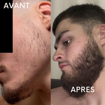 2 ACTIVATEUR DE POUSSE + ROLLER OFFERT - CURE 2 MOIS