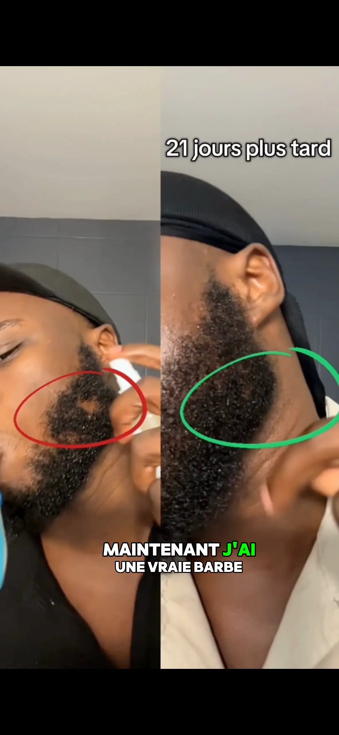 2 ACTIVATEUR DE POUSSE + ROLLER OFFERT - CURE 2 MOIS