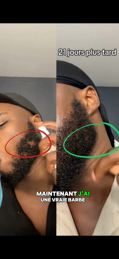 2 ACTIVATEUR DE POUSSE + ROLLER OFFERT - CURE 2 MOIS