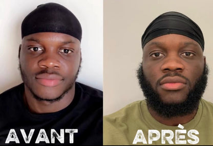 3 ACTIVATEURS DE POUSSE + ROLLER OFFERT - LA CURE DE 3 MOIS POUR UN DEBUT DE BARBE™