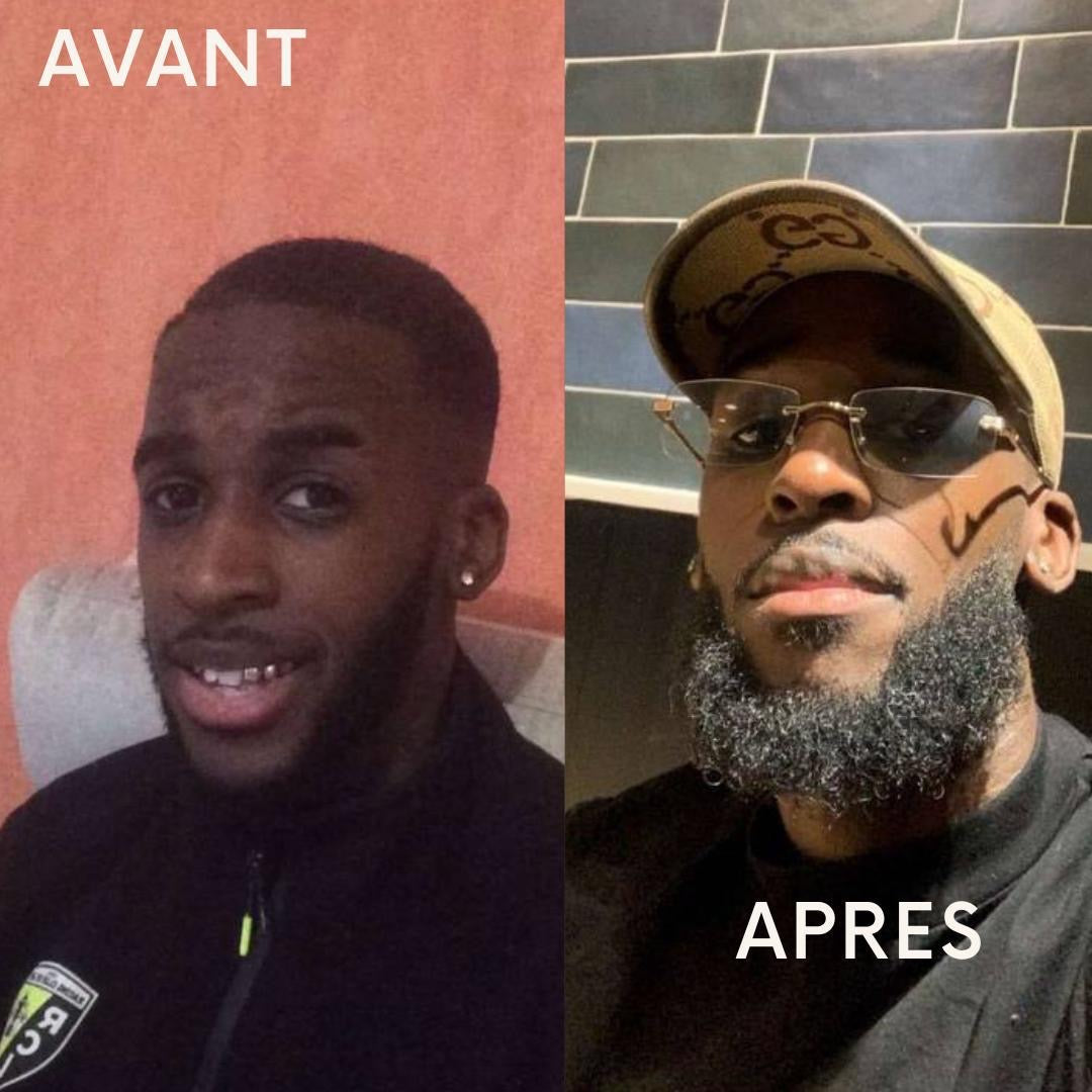 3 ACTIVATEURS DE POUSSE + ROLLER OFFERT - LA CURE DE 3 MOIS POUR UN DEBUT DE BARBE™