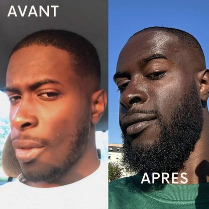 3 ACTIVATEURS DE POUSSE + ROLLER OFFERT - LA CURE DE 3 MOIS POUR UN DEBUT DE BARBE™