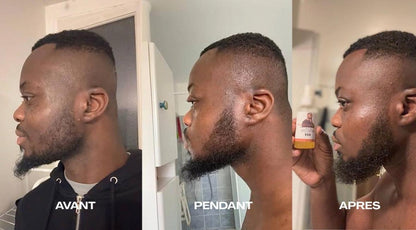 2 ACTIVATEUR DE POUSSE + ROLLER OFFERT - CURE 2 MOIS