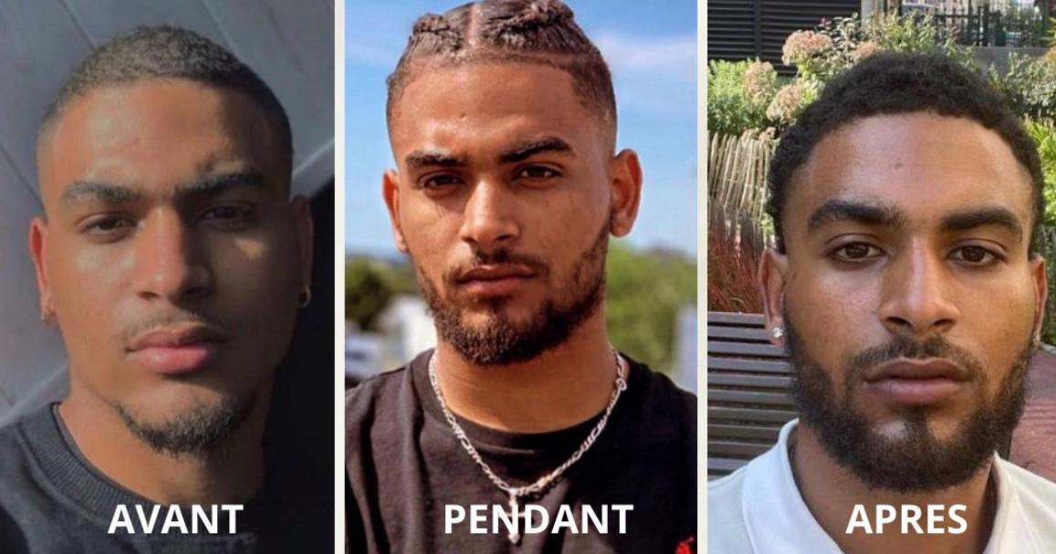 2 ACTIVATEUR DE POUSSE + ROLLER OFFERT - CURE 2 MOIS