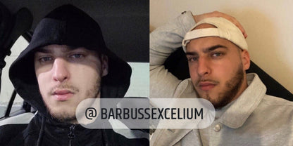 ACTIVATEUR DE POUSSE + BEARD ROLLER - Barbussexcelium