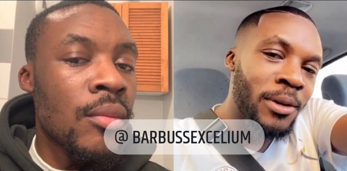ACTIVATEUR DE POUSSE + BEARD ROLLER - Barbussexcelium
