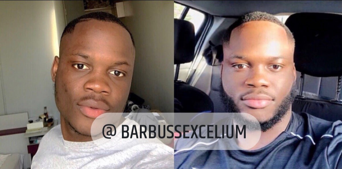 BARBUSSACTIVATEUR - ACTIVATEUR DE POUSSE ! - Barbussexcelium